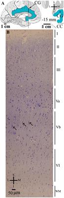 Dendritic and Spine Heterogeneity of von Economo Neurons in the Human Cingulate Cortex